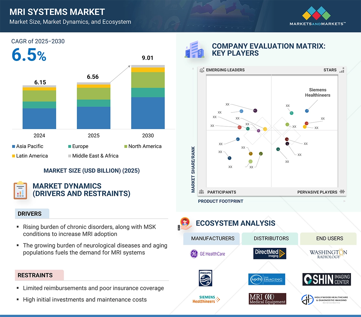 MRI Systems Market Global Forecast and Key Opportunities to 2030